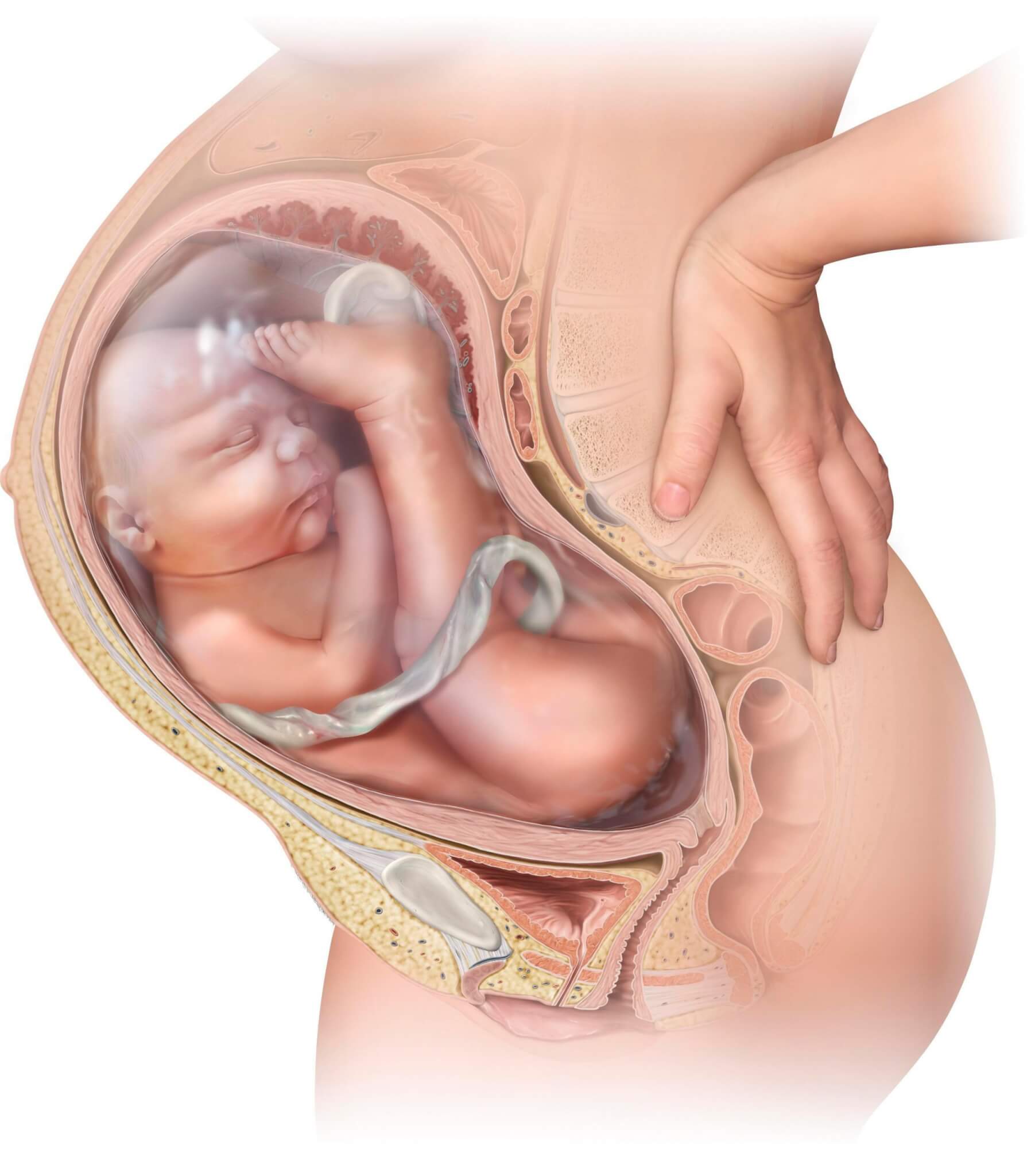 Breech Baby – This baby is not for turning!